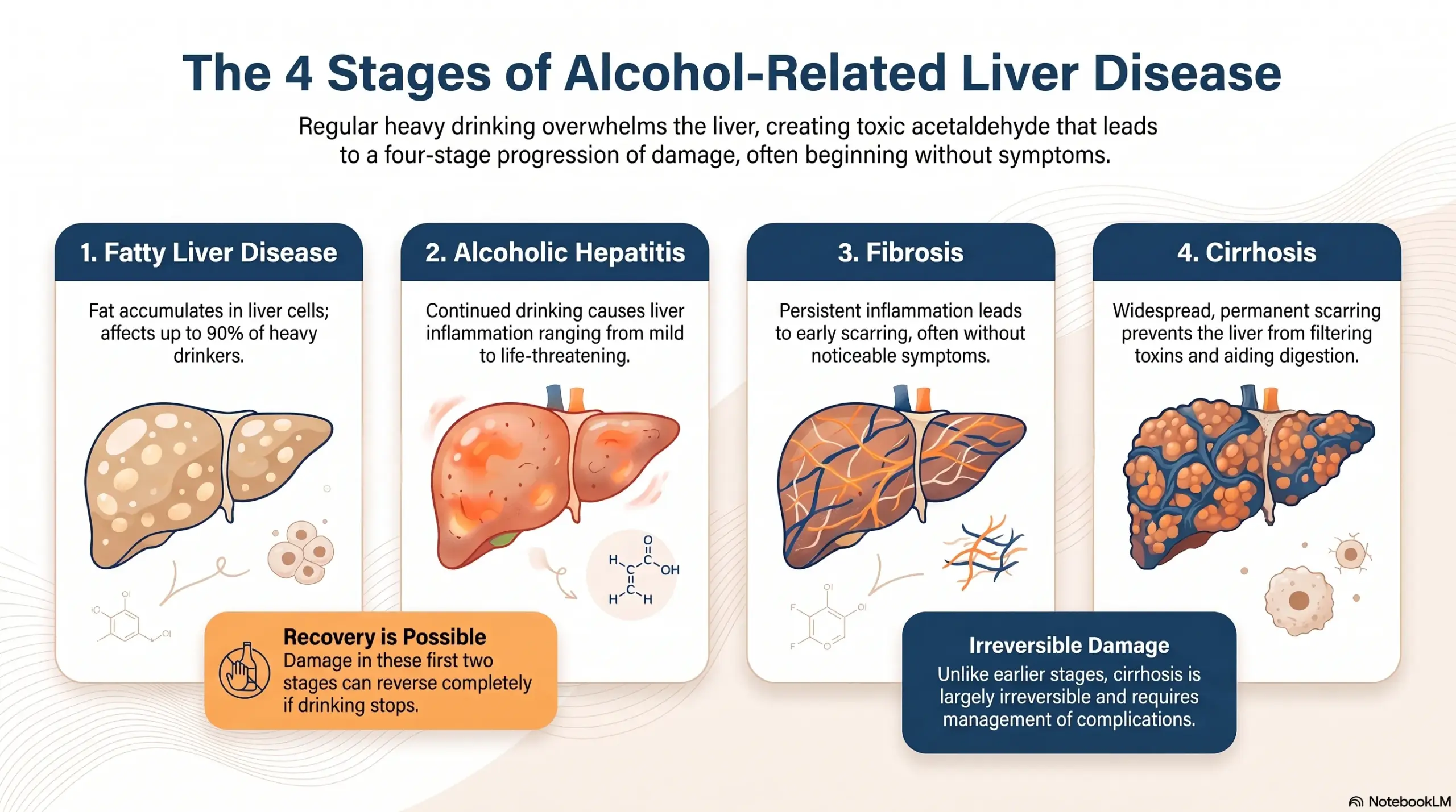 Infographic "The 4 Stages of Alcohol-Related Liver Disease" showing four cards — 1. Fatty Liver Disease, 2. Alcoholic Hepatitis, 3. Fibrosis, 4. Cirrhosis — with notes that the first two stages can reverse completely if drinking stops, while cirrhosis is largely irreversible.